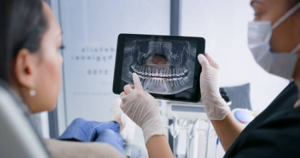 Licensed Tooth Extraction service in Charlotte, NC - Smile Center Dentistry